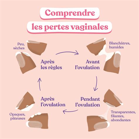 perte blanche|Pertes vaginales blanches, quand sinquiéter et quand。